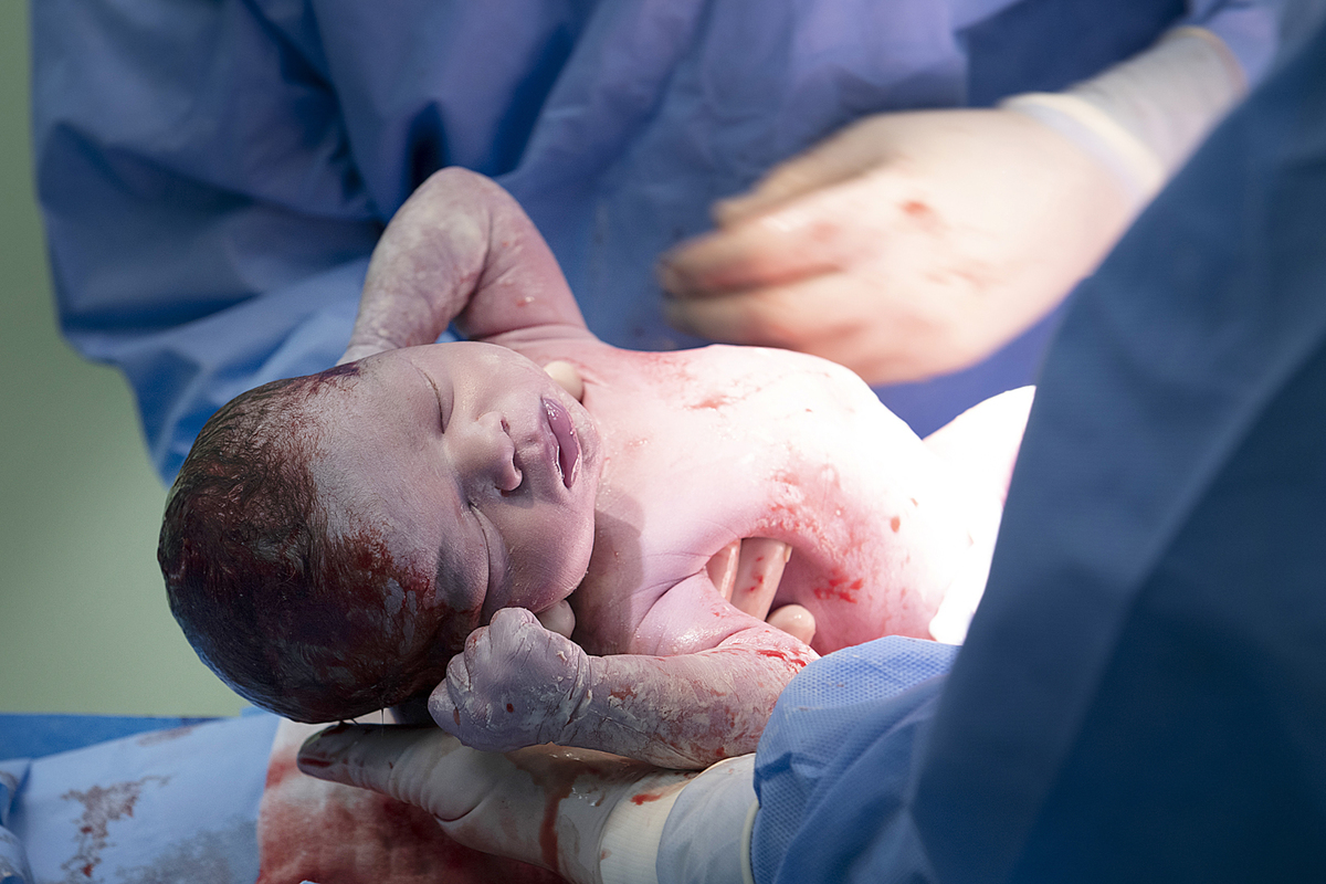 fotografia de nascimento, parto, cesaria, cesariana, nascimento, tania bauer fotografia, fotografia de parto, 