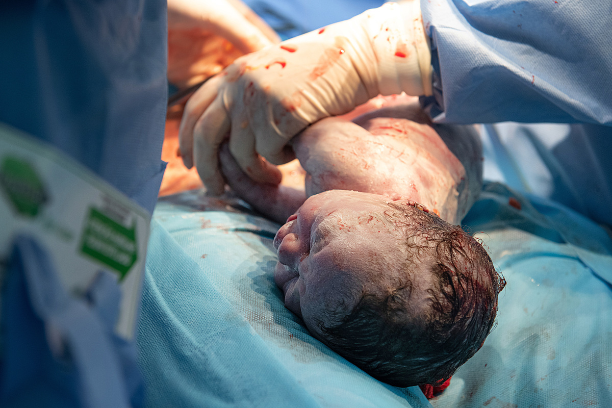 cesariana, fotografia de familia, cesariana, parto, cemox, tania bauer fotografia, tania bauer, fotografa de sao bento do sul, nascimento Alice