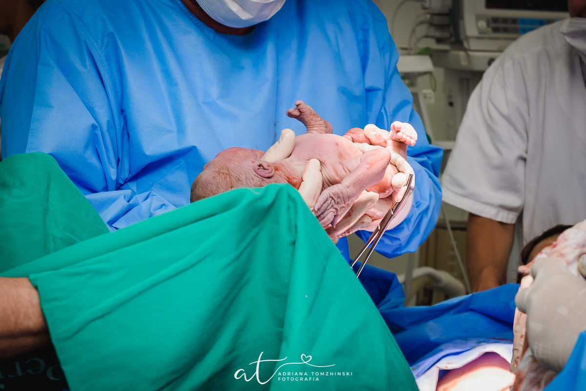 parto, nascimento, cesarea, cesareana, bebê, baby, newborn, perinatal, laranjeiras, fotografia de parto, milagre da vida