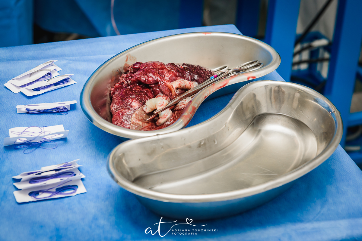 parto, nascimento, cesarea, cesareana, bebê, baby, newborn, perinatal, laranjeiras, fotografia de parto, milagre da vida, placenta