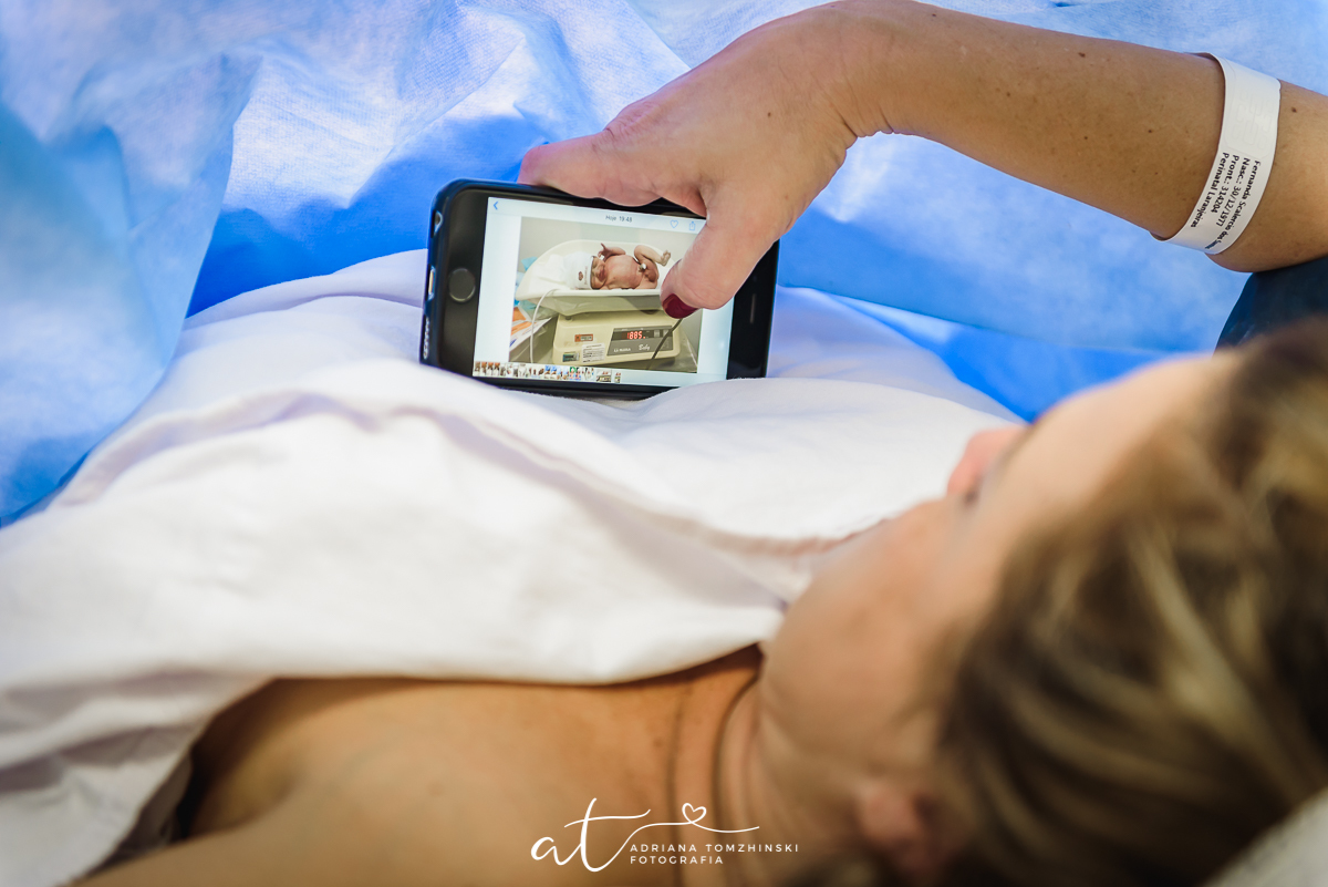 parto, nascimento, cesarea, cesareana, bebê, baby, newborn, perinatal, laranjeiras, fotografia de parto, milagre da vida