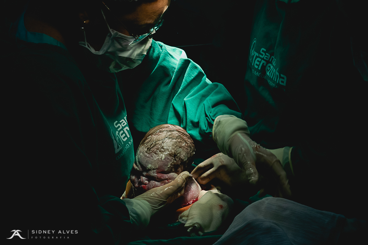Hospital Santa Terezinha, fotografia de parto, nascimento do Isaac