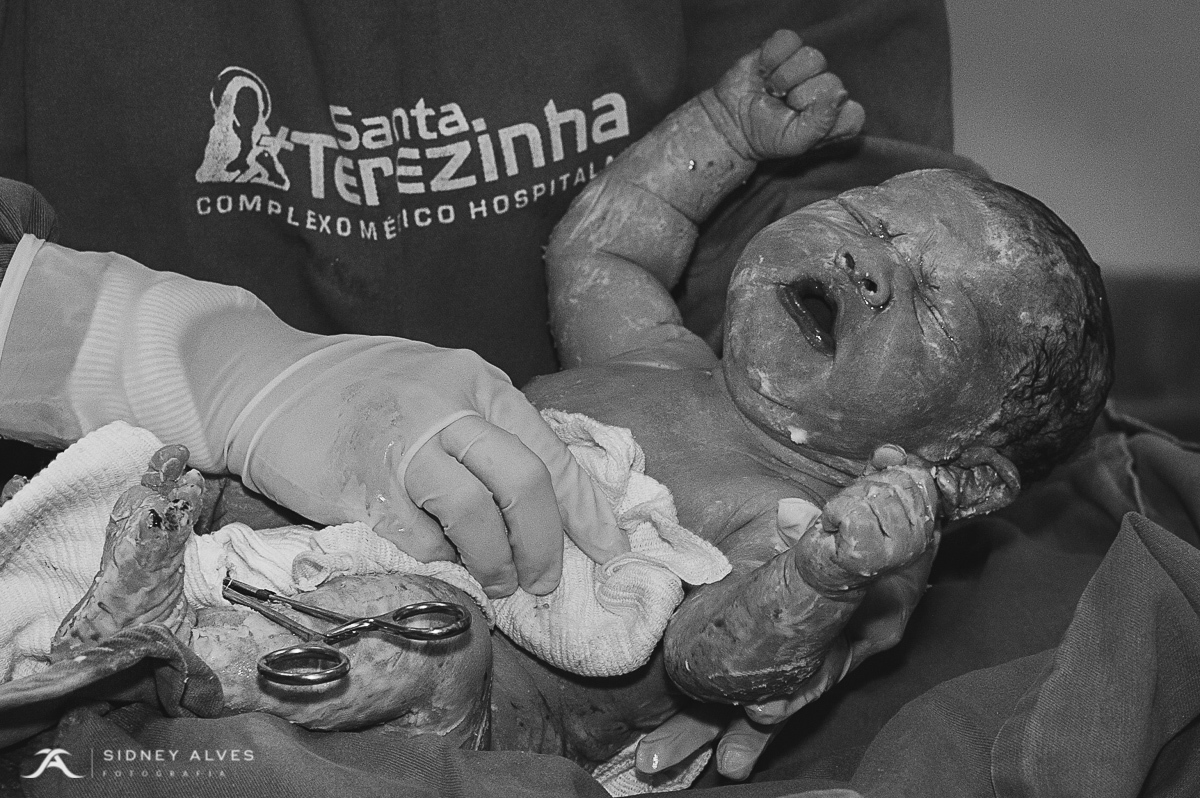 Hospital Santa Terezinha, fotografia de parto, nascimento do Isaac