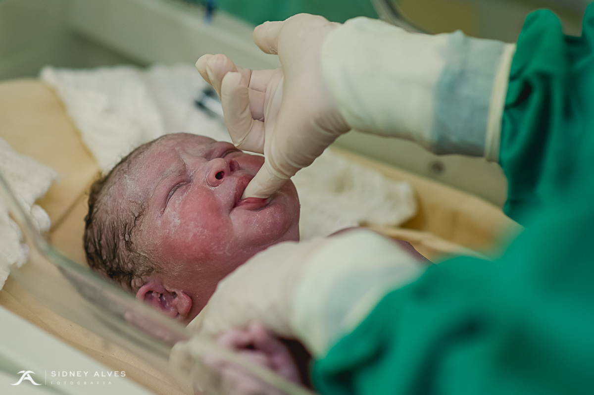 Hospital Santa Terezinha, fotografia de parto, nascimento do Isaac