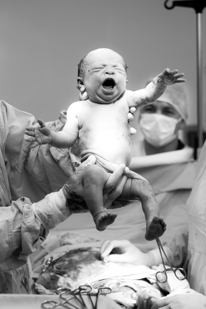 hora exata do nascimento da bebê Maria Laura, fotografado pela fotógrafa de partos em rio negrinho Aline paim, doutor reis foi quem fez o parto cesariana.