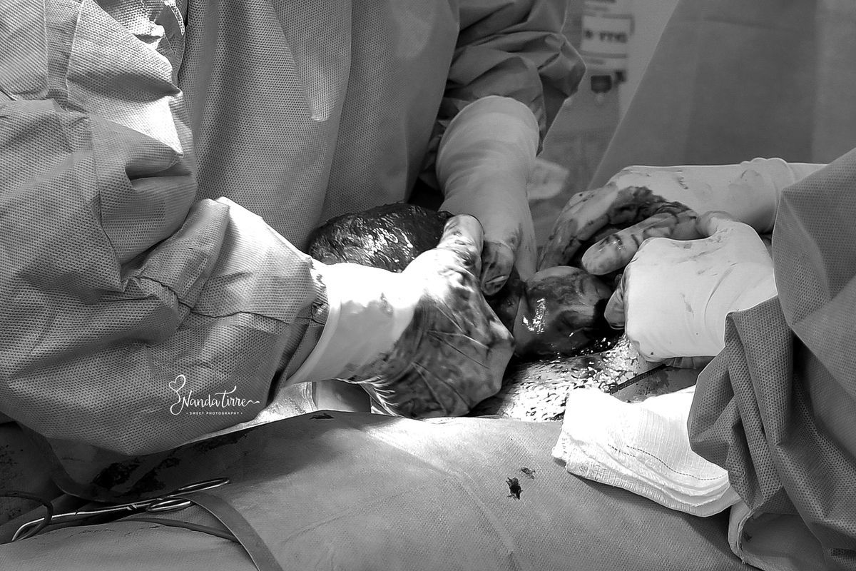 newborn-recem-nascido-bebê-baby-fotografia-fotógrafo-foto-book-ensaio-fotográfico-estúdio-nanda-tirre-photo-maternidade-perinatal-cssj-mãe-pai-grávida-gravidez-gestante-gestação-rio-de-janeiro-rj-parto-amamentação-photography-RJ-normal-cesárea-nascimento
