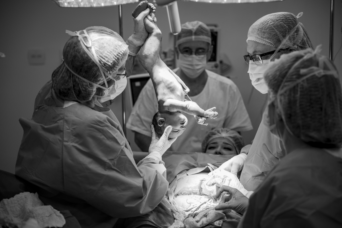 parto-nascimento-foto-fotografia-fotografo-cesarea-recem-nascido-bebê-newborn-rio de janeiro-rj-teresópolis-maternidade-perinatal-normal-vaginal-natural-obstetra-pediatra-família-berçário-nascer-hctco-doula-gestante-grávida-amamentação-gestação-mãe-video