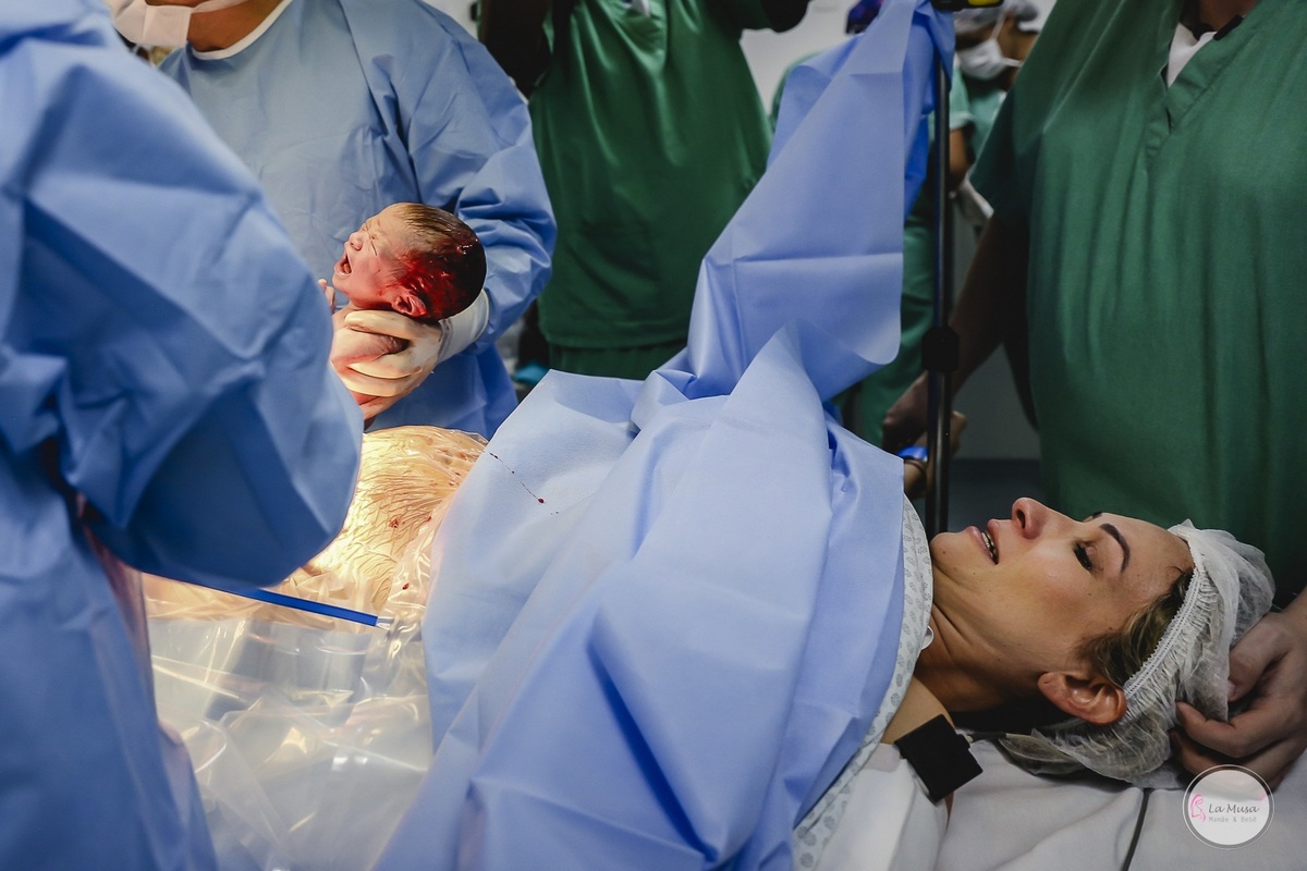 Fotografia de Parto, Filmagem de Parto, Parto cesário, parto Hospital Maternidade Brasília, Hospital Santa Luzia, Maternidade Brasilia, Fotografia nascimento