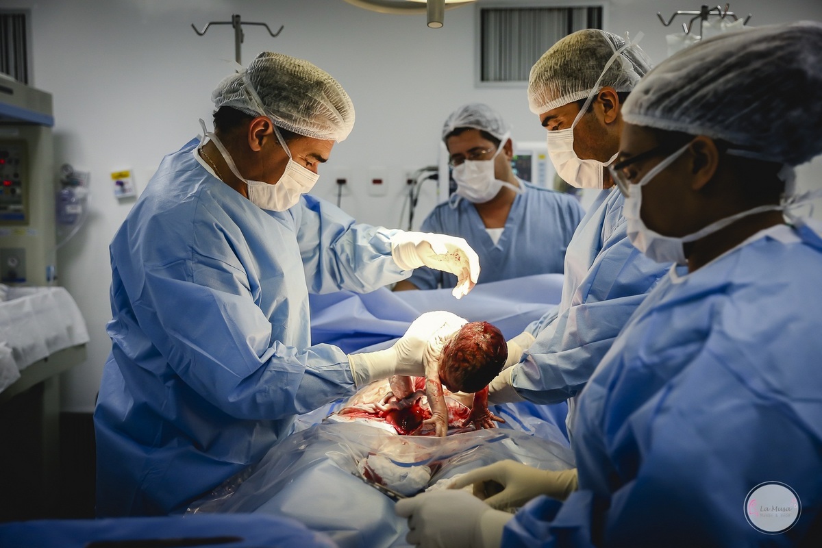 Fotografia de Parto, Filmagem de Parto, Parto cesário, parto Hospital Maternidade Brasília, Hospital Santa Luzia, Maternidade Brasilia, Fotografia nascimento