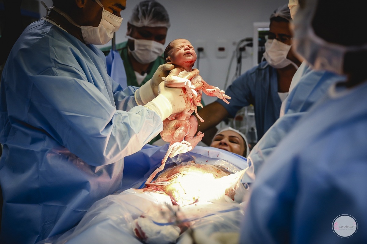 Fotografia de Parto, Filmagem de Parto, Parto cesário, parto Hospital Maternidade Brasília, Hospital Santa Luzia, Maternidade Brasilia, Fotografia nascimento