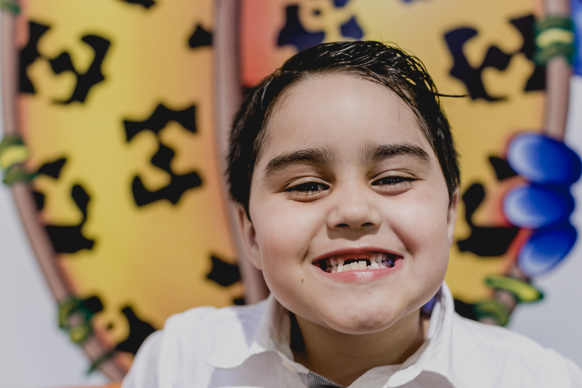 amiguinho mostrando a banguelinha