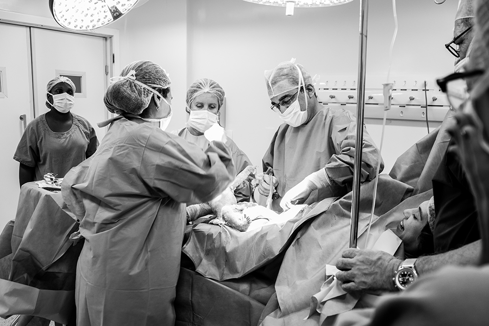 Cobertura fotográfica de parto nascimento cesárea parto normal maternidade menina recém nascida mãe obstetra sala de parto niteroi rio de janeiro são Gonçalo