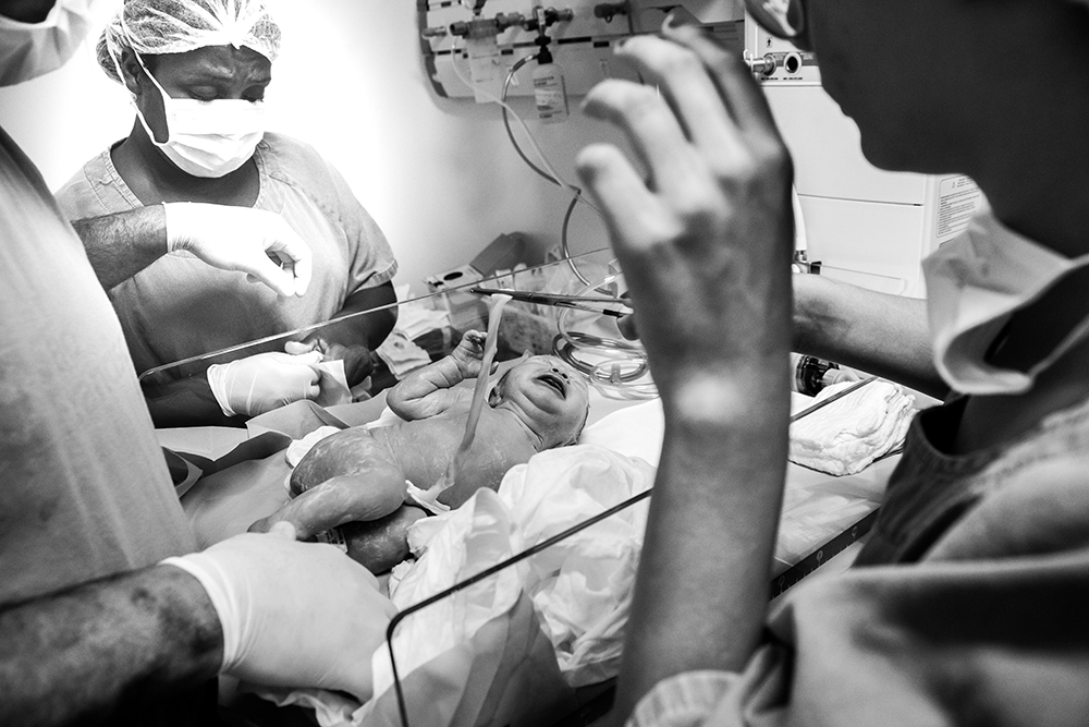 Cobertura fotográfica de parto nascimento cesárea parto normal maternidade menina recém nascida mãe obstetra sala de parto niteroi rio de janeiro são Gonçalo