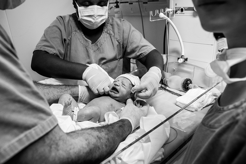 Cobertura fotográfica de parto nascimento cesárea parto normal maternidade menina recém nascida mãe obstetra sala de parto niteroi rio de janeiro são Gonçalo