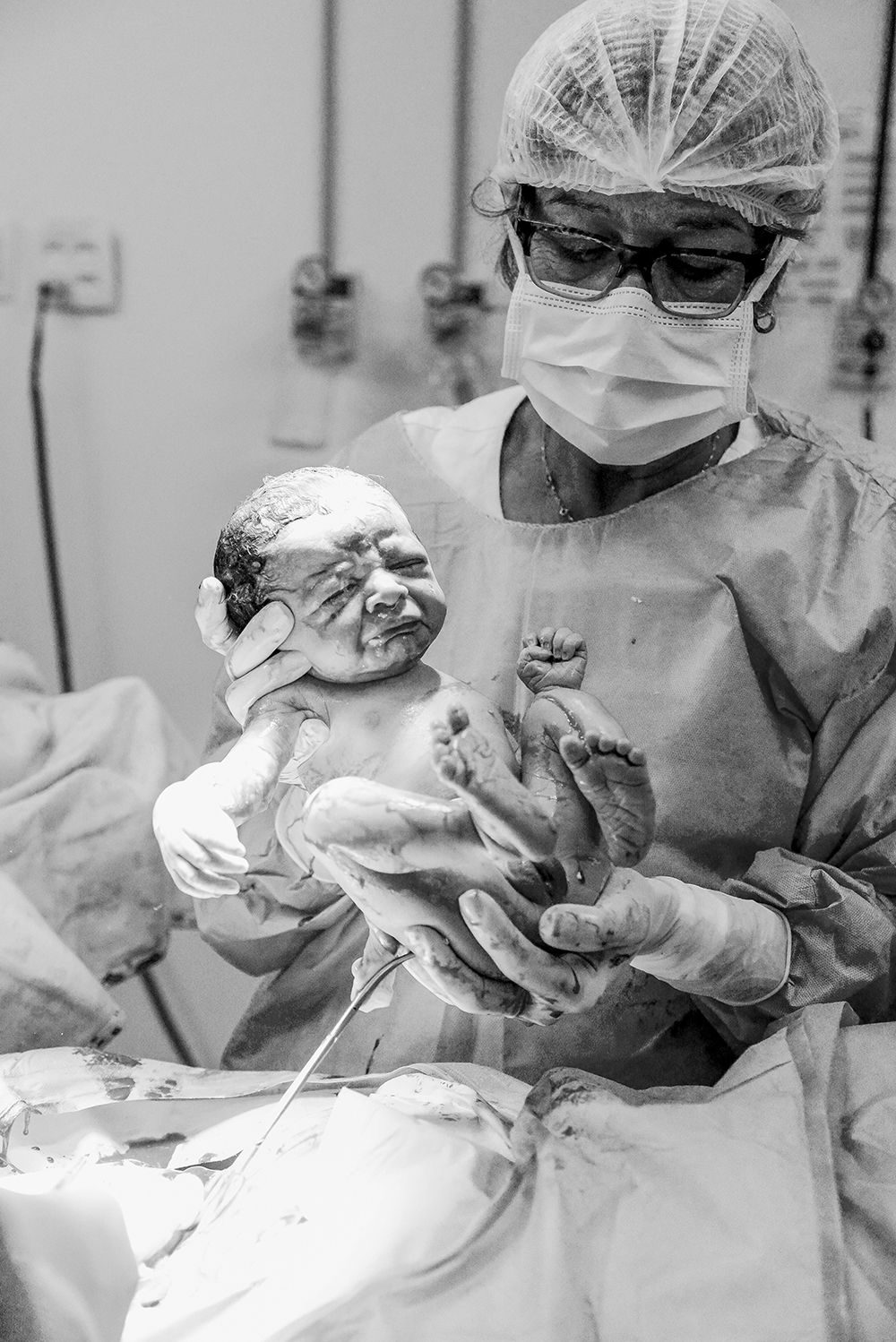 Cobertura fotográfica de parto nascimento cesárea parto normal maternidade menina recém nascida mãe pai obstetra sala de parto niteroi rio de janeiro são Gonçalo