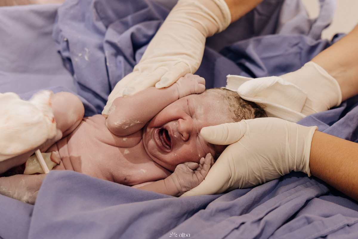 Recém-nascido chora durante os primeiros cuidados da equipe médica após o parto no Hospital Bruno Born, em Lajeado. Fotografia de nascimento por Alba Estúdio.