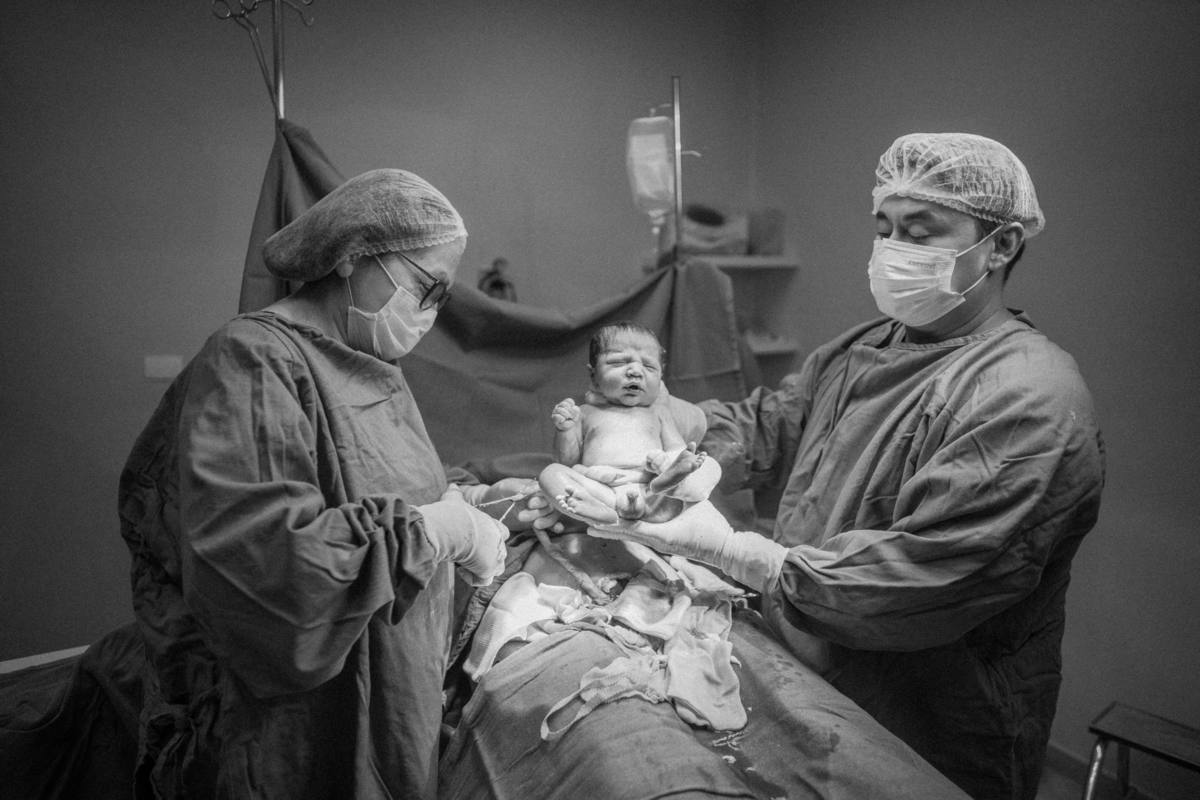 fotografia de parto, Davi Martins, davimartins, hospital bom clima