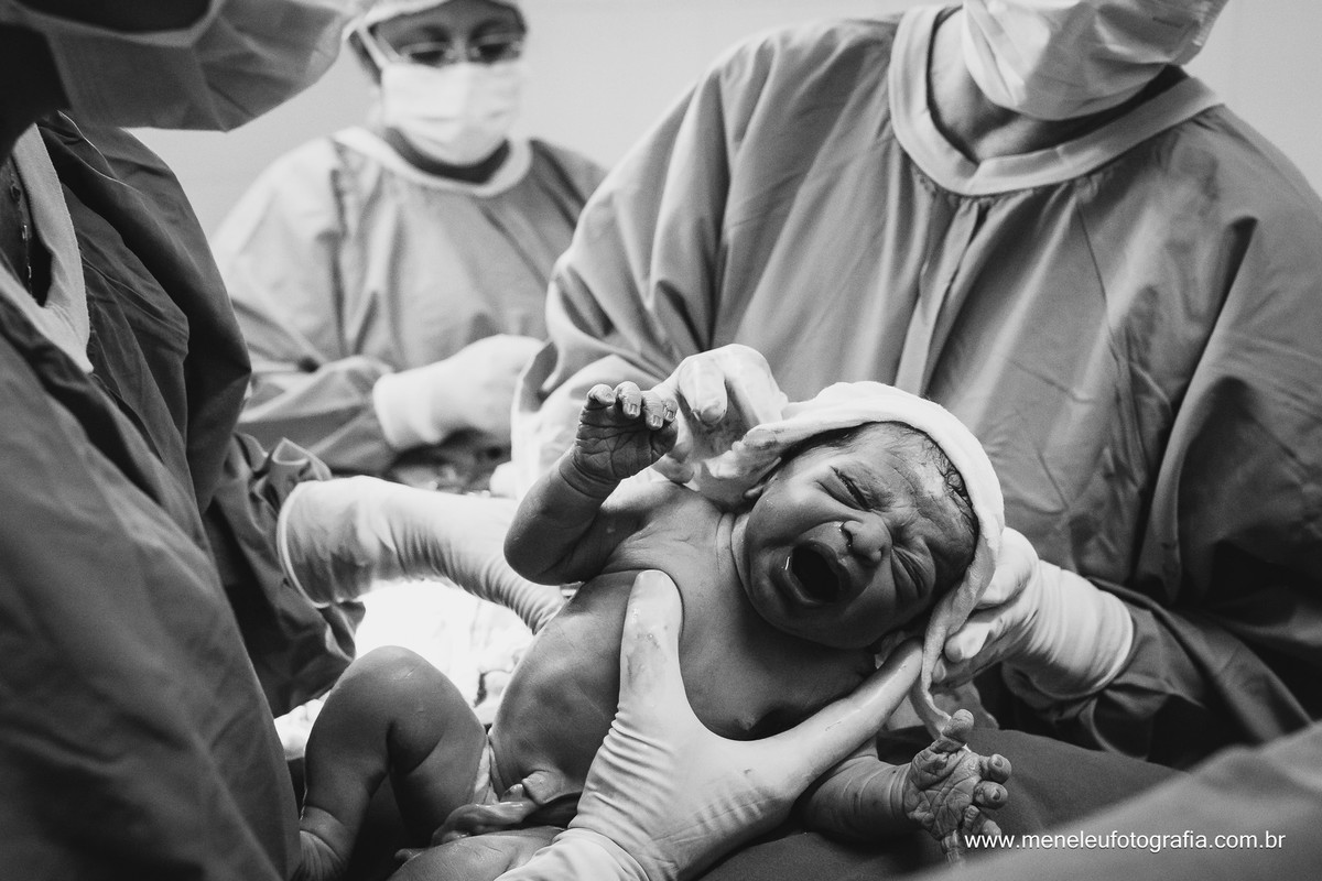 Fotografia de parto, fotografo em fortaleza, fotografia de parto em fortaleza, parto, hospital cura d'ars,