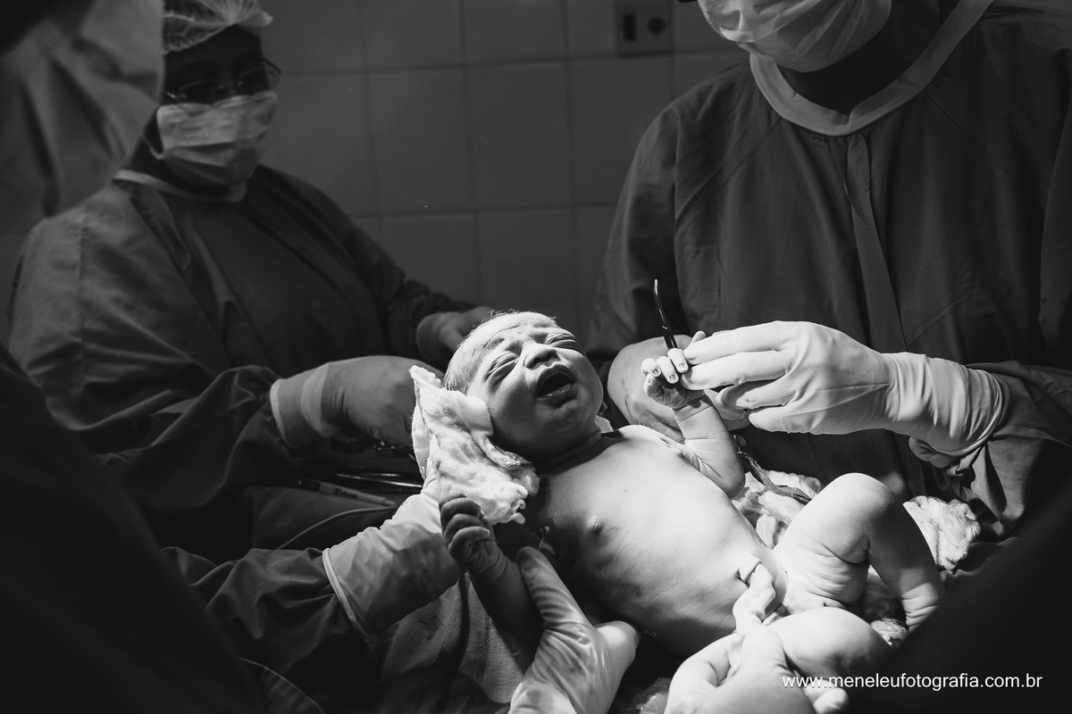 Fotografia de parto, fotografo em fortaleza, fotografia de parto em fortaleza, parto, hospital cura d'ars,