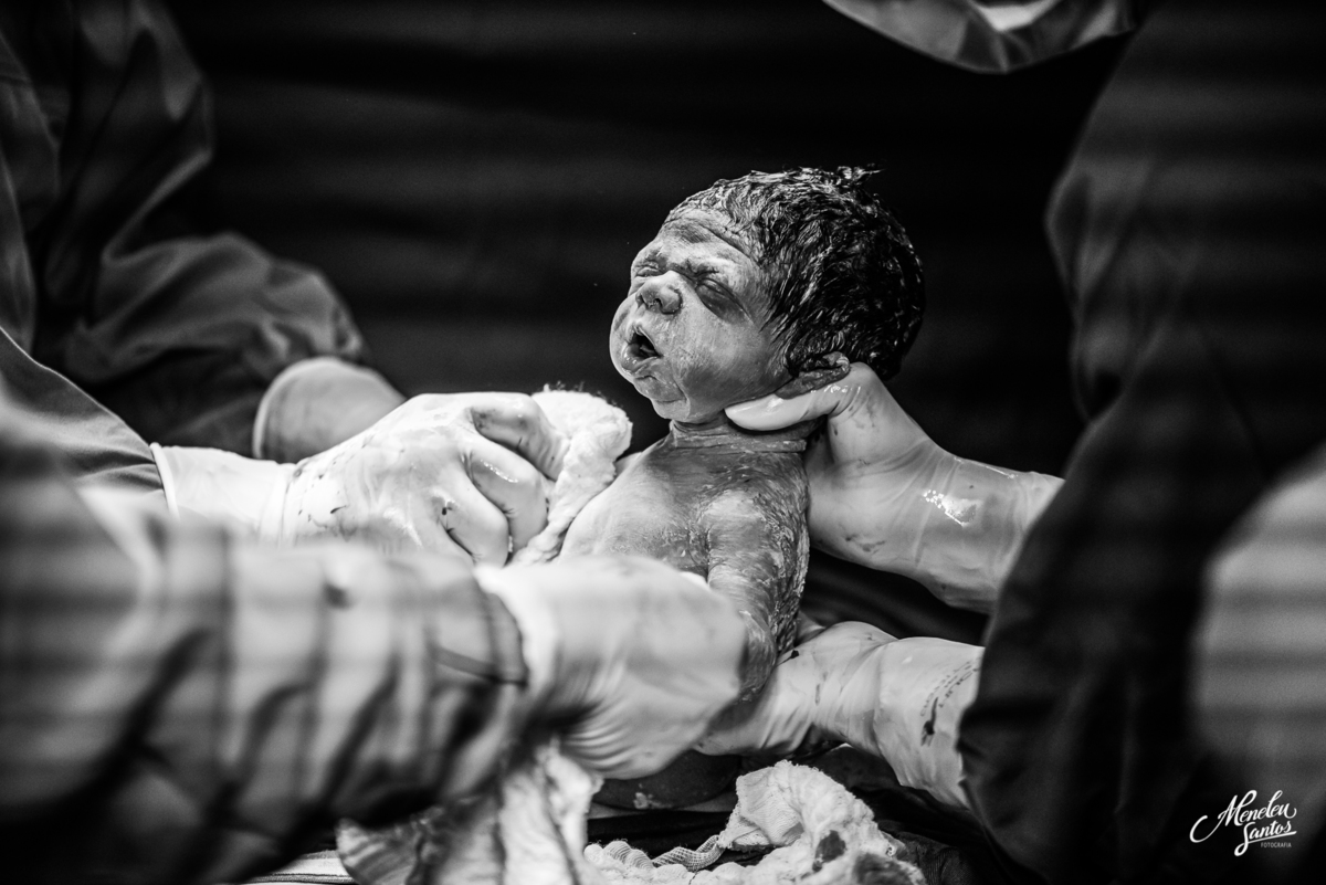 Fotografia de parto por fotografo em fortaleza meneleu santos 