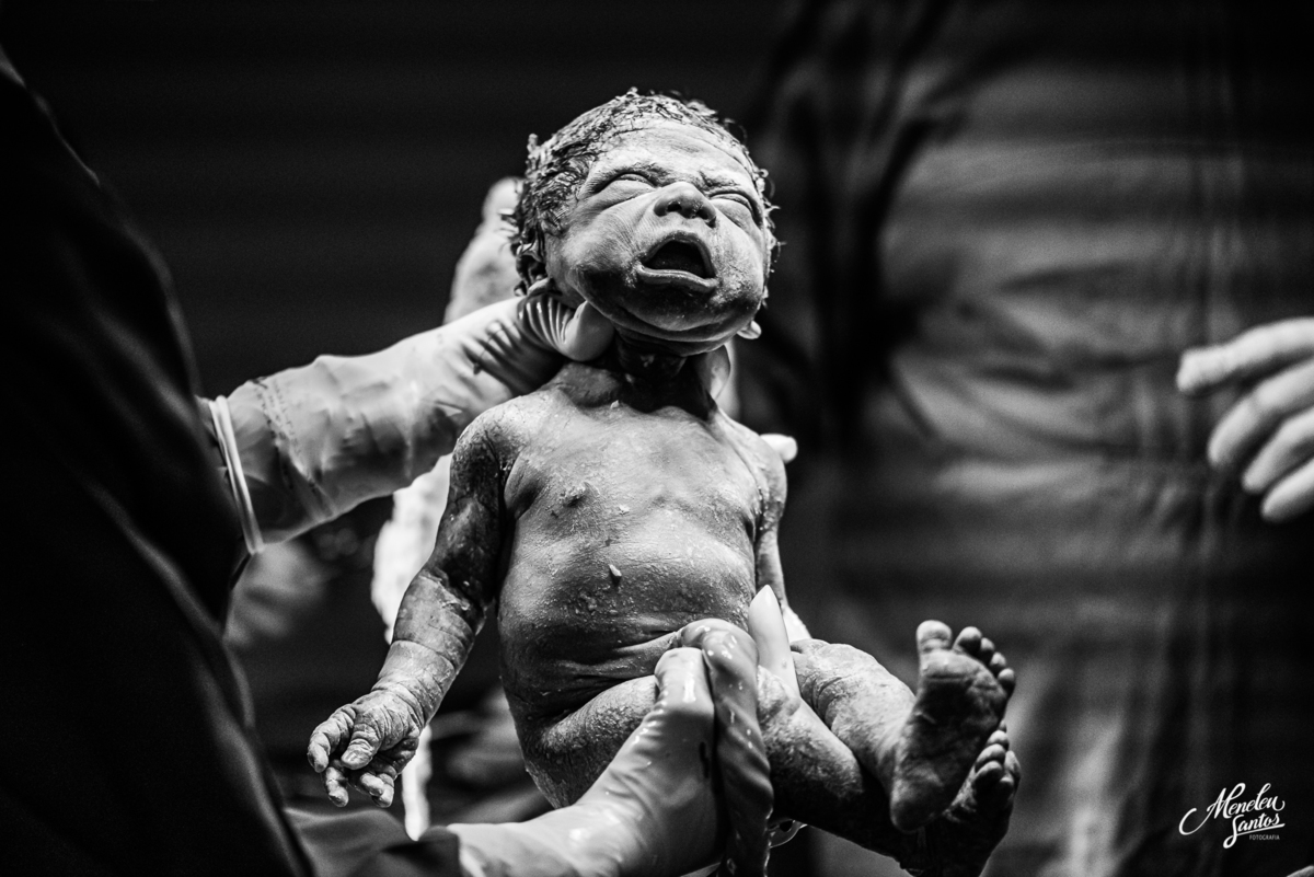 Fotografia de parto por fotografo em fortaleza meneleu santos 