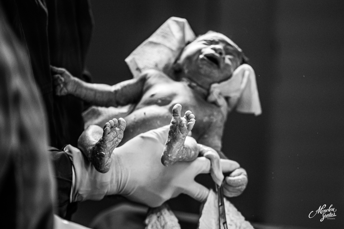 Fotografia de parto por fotografo em fortaleza meneleu santos 