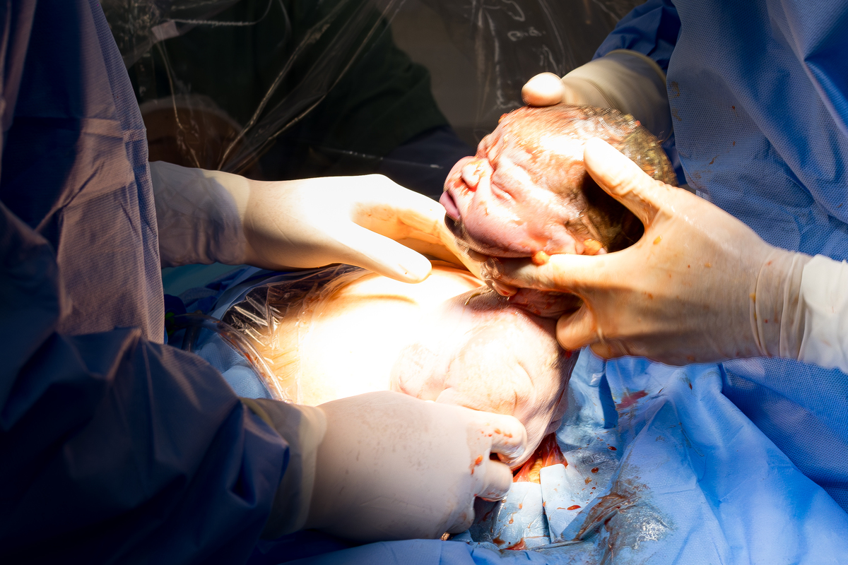 Fotografia de Parto - Maternidade Santa Joana - São Paulo