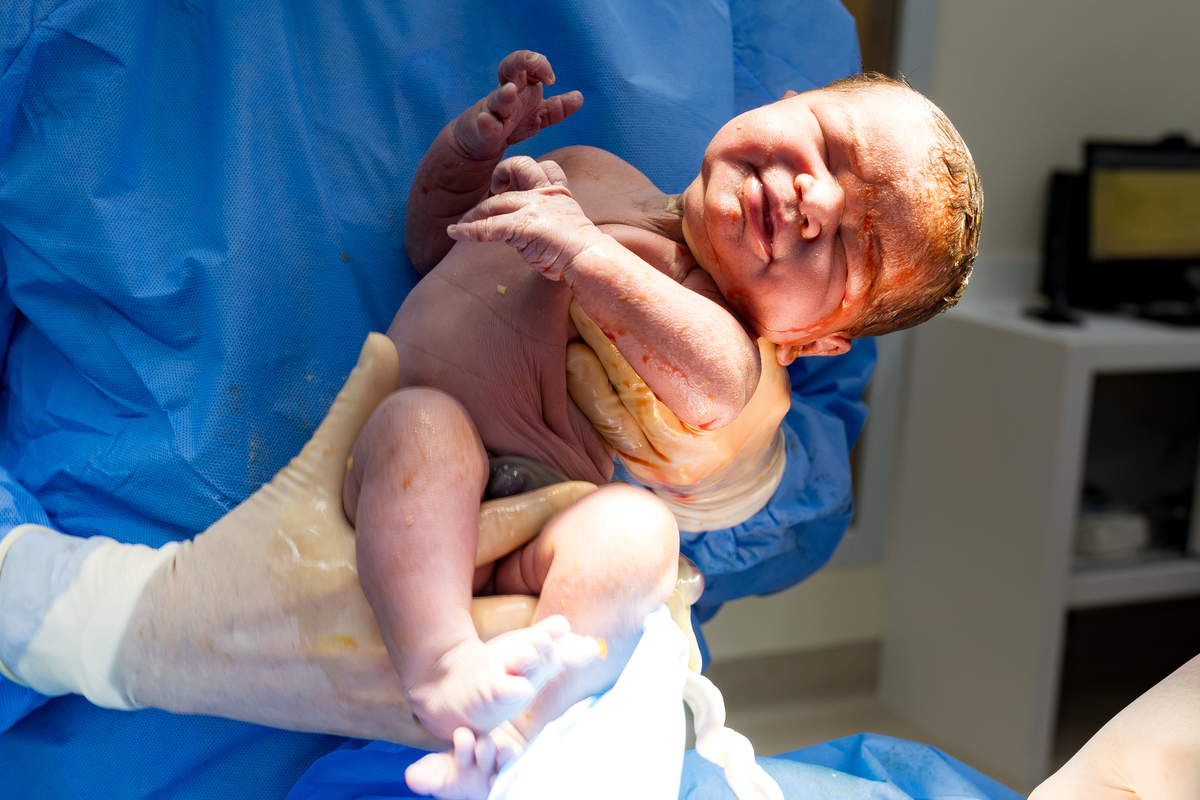 Fotografia de Parto - Maternidade Santa Joana - São Paulo