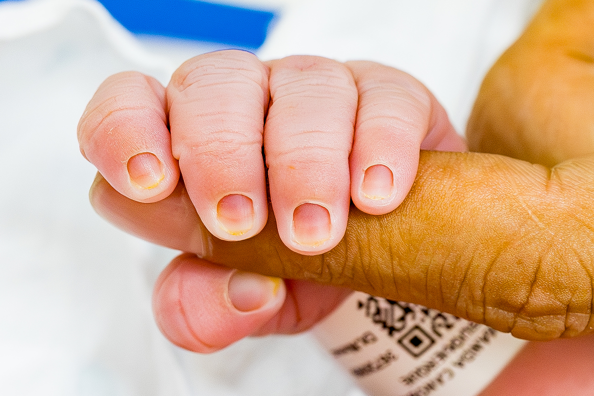 Fotografia de Parto - Maternidade Santa Joana - São Paulo