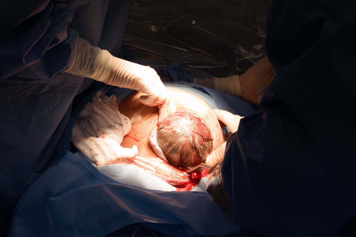 Nascimento do Hugo - ProMatre Paulista - Dr. Ricardo Esteban