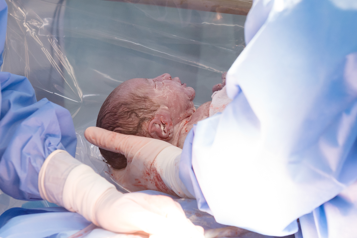 Nascimento do Hugo - ProMatre Paulista - Dr. Ricardo Esteban