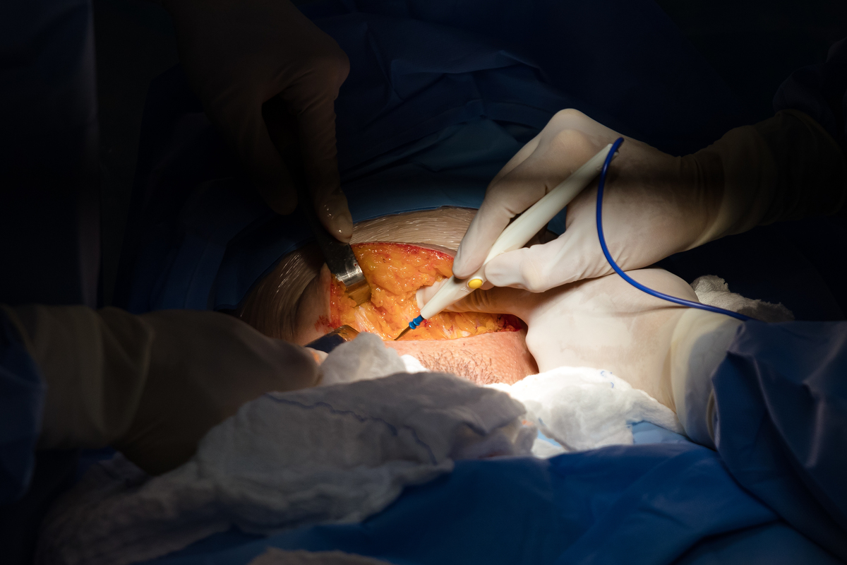 O nascimento do Raul - Fotografia de Parto - Promatre Paulista