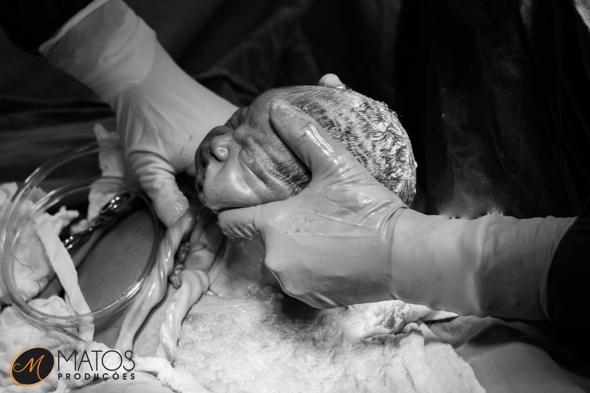 Fotografia Documental de Parto em Santos - Hospital Ana Costa