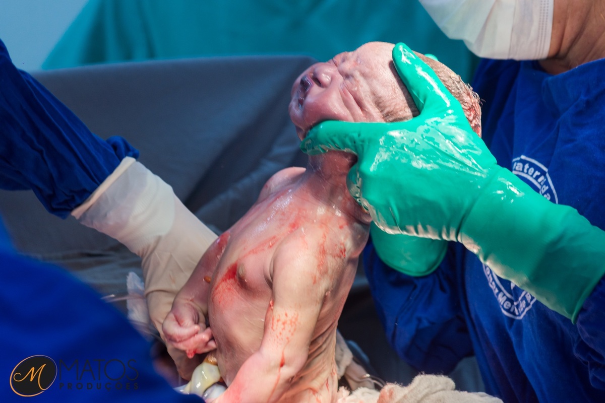 Fotografia Documental de Parto em Santos - Hospital Ana Costa