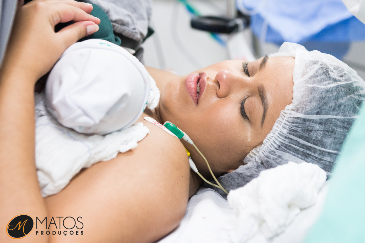 Fotografia Documental de Parto em Santos - Hospital Ana Costa