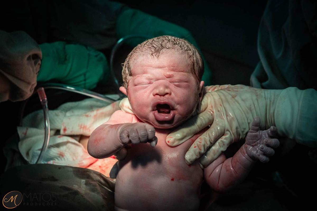 Fotografia Documental de Parto em Santos - Hospital Ana Costa