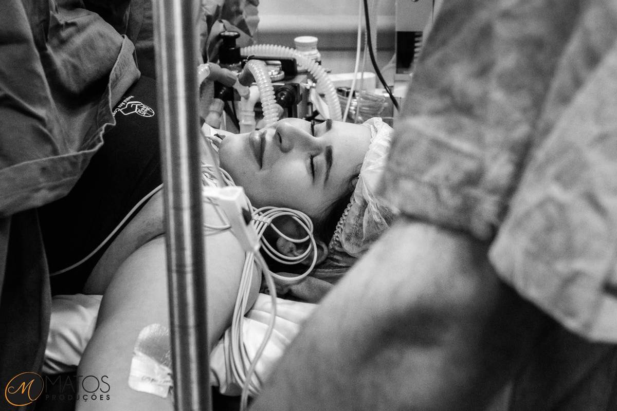 Fotografia Documental de Parto em Santos - Hospital Ana Costa