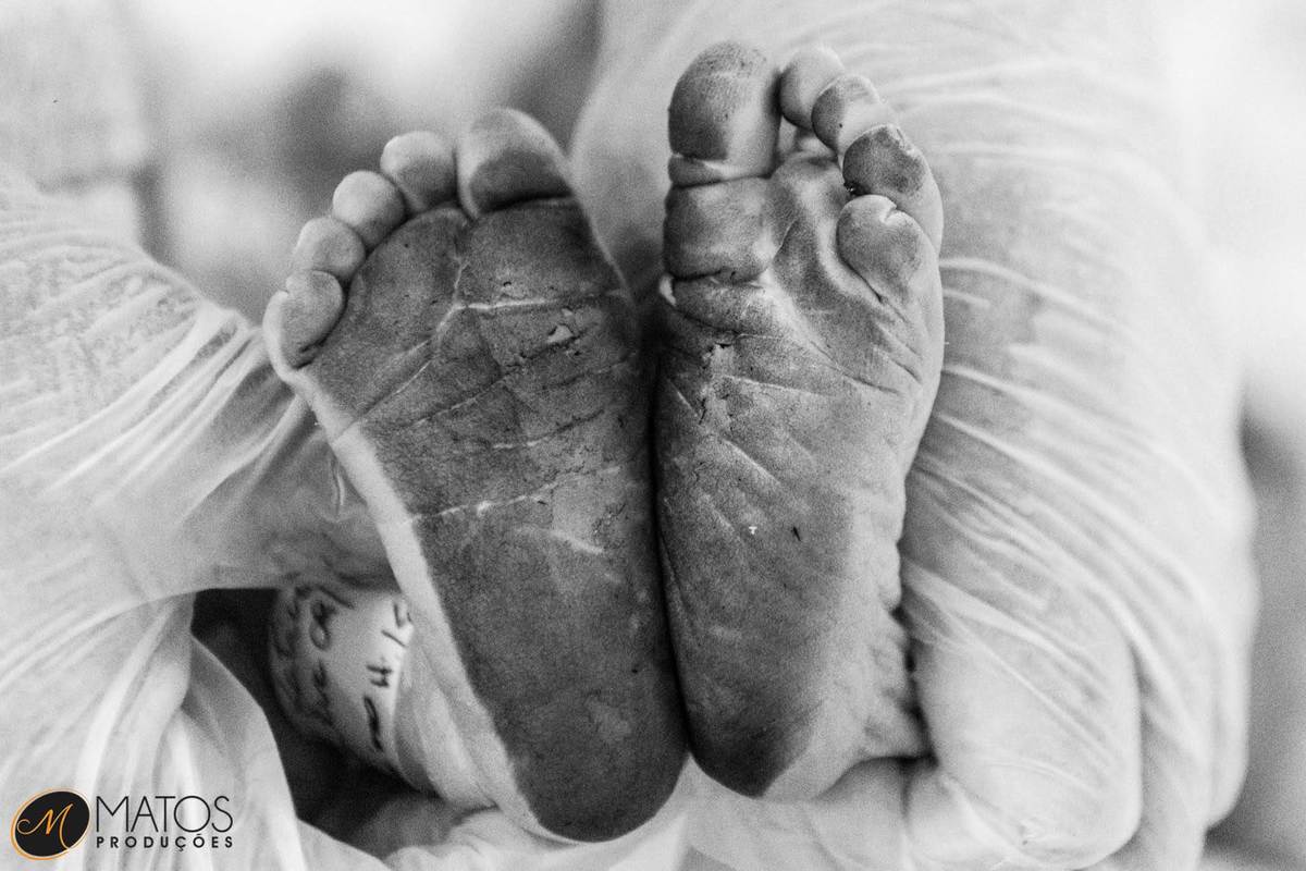 Fotografia Documental de Parto em Santos - Hospital Ana Costa