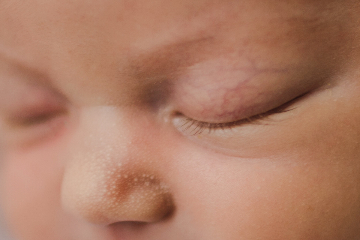 detalhes newborn porto