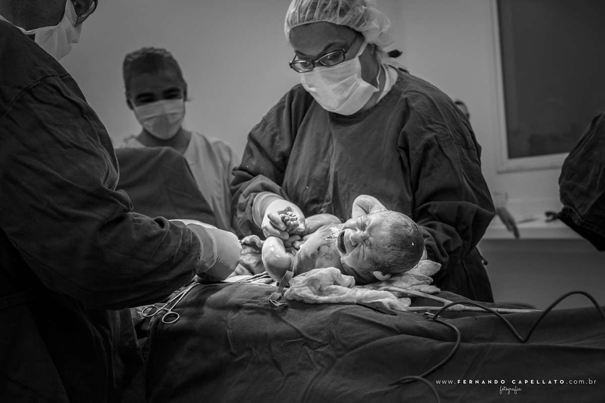 Parto Cesárea | Pro Matre | A chegada de Arthur