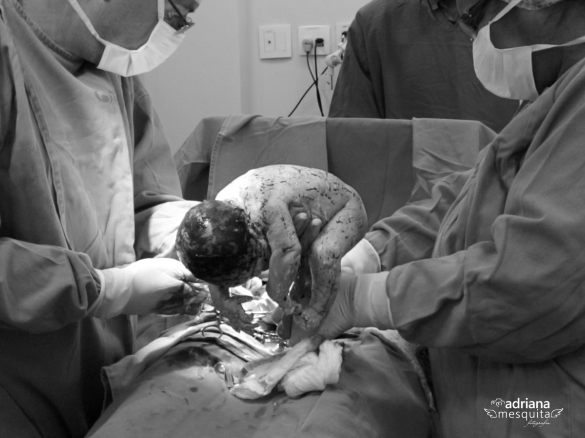 Parto Antonella, registro pela fotografa Adriana Mesquita no Hospital Santa Genoveva