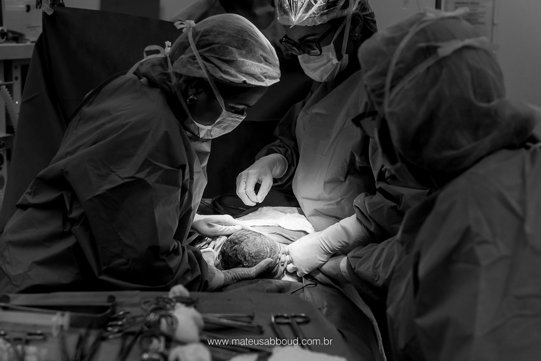 Equipe médica iniciando a retirada do bebê da barriga da mãe.