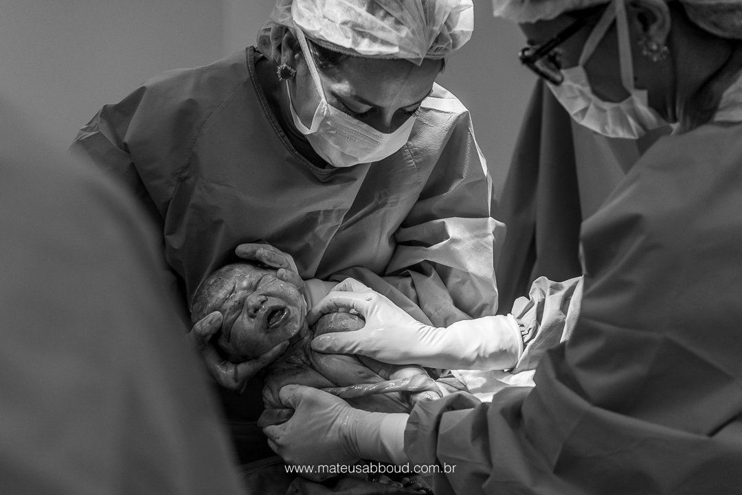 Bebê com a cabeça e com o tronco fora da barriga da mãe.