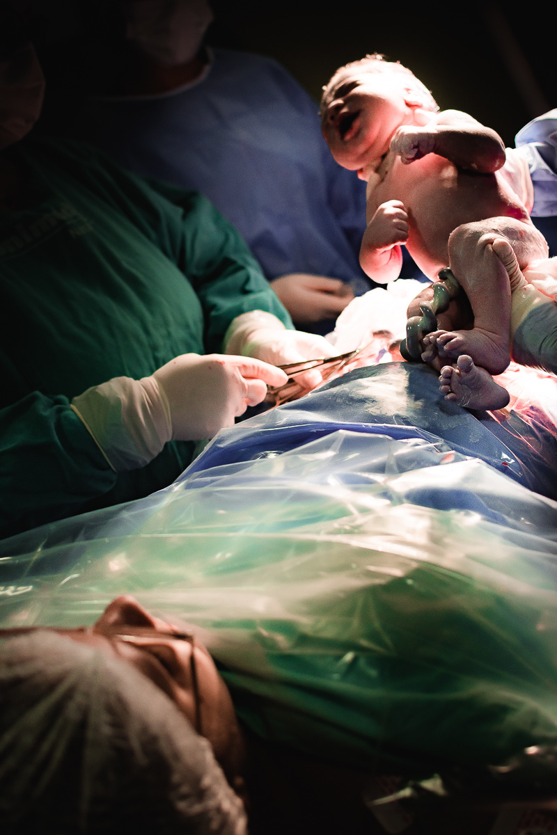 Agora mãe e bebê são dois, após o corte do cordão umbilical