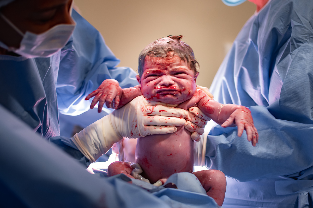 foto de uma bebê que acabou de nascer