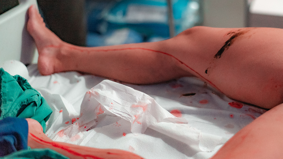 Foto de parto mostra a natureza acontecendo.