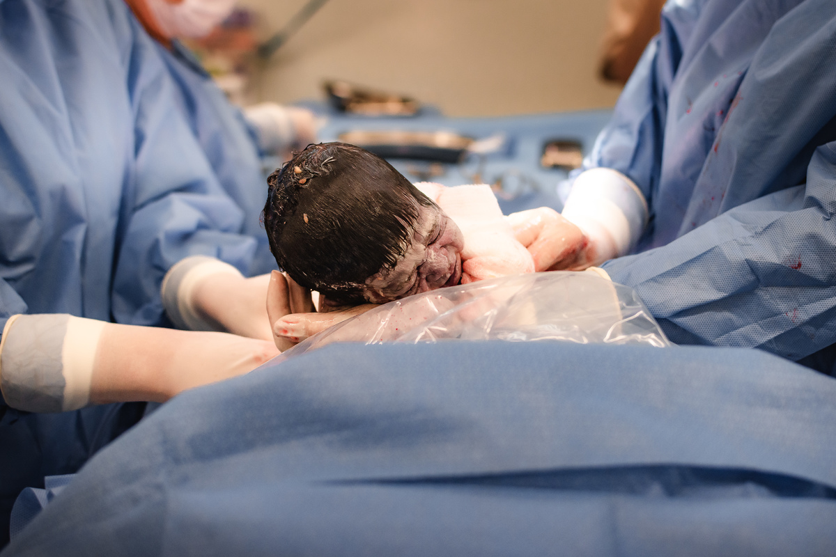 foto de aprto em natal - bebê nasceu
