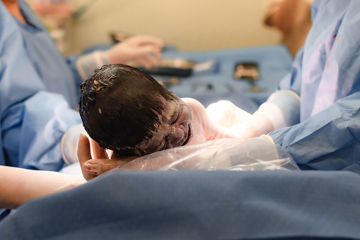 foto de aprto em natal - bebê nasceu