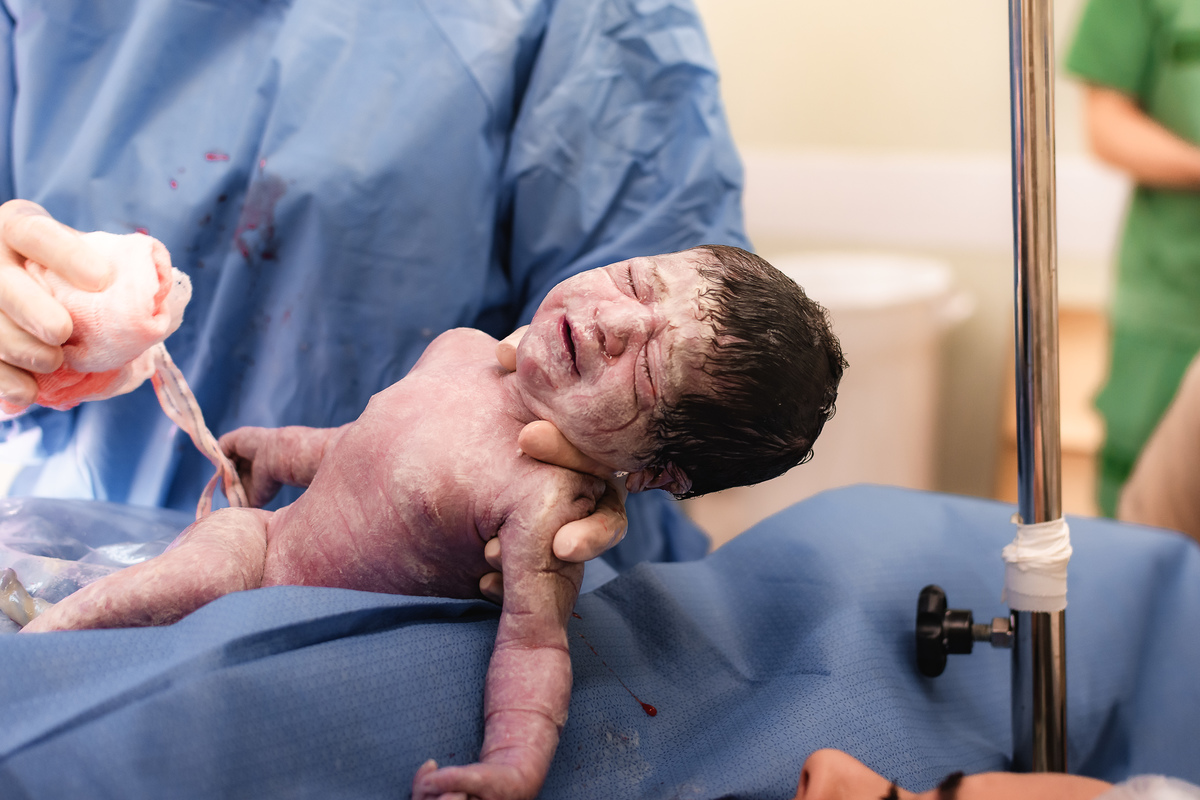 foto de aprto em natal rn - bebê nasceu