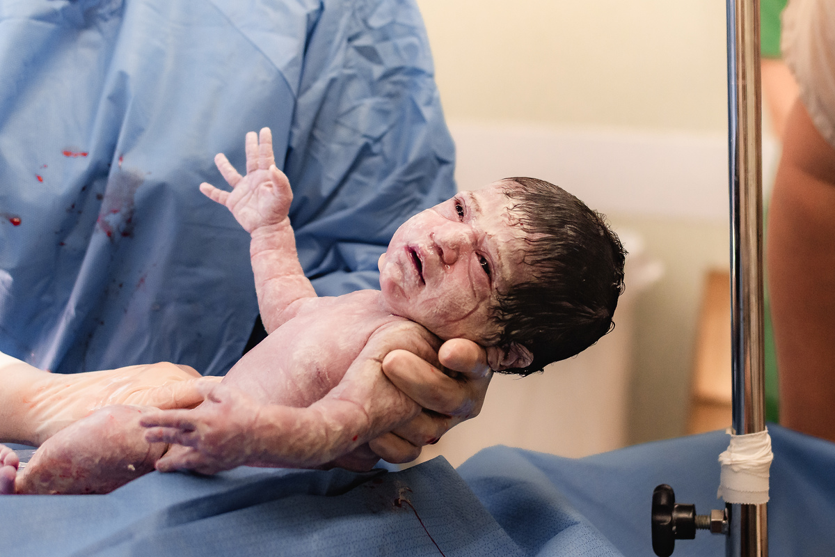 foto de aprto em natal rn - bebê nasceu